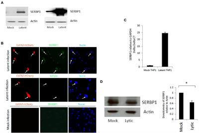 Latency-associated upregulation of SERBP1 is important for the recruitment of transcriptional repressors to the viral major immediate early promoter of human cytomegalovirus during latent carriage